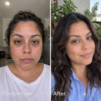 The Korean 3-in-1 Foundation for Postpartum Skin