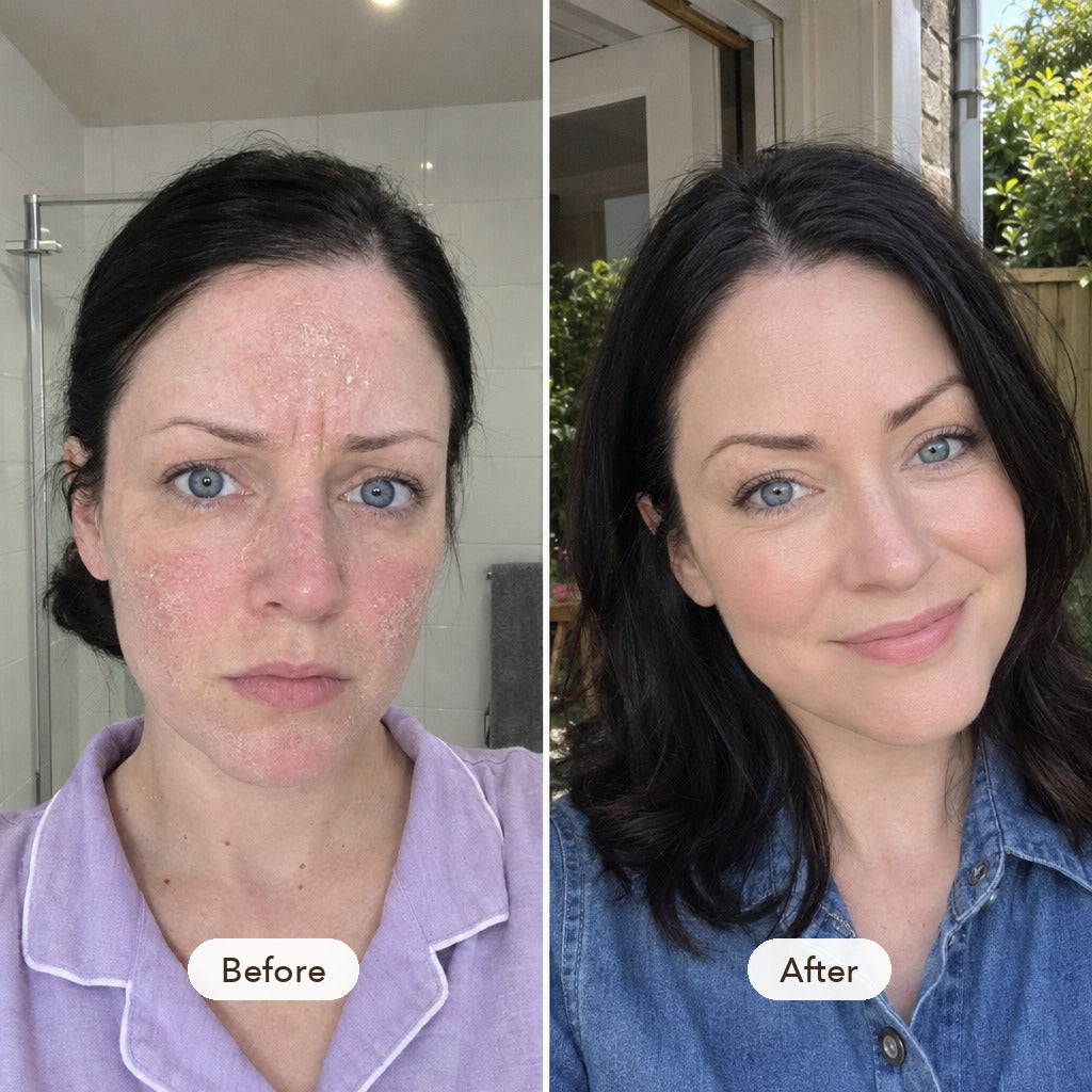 Soft, hydrated skin